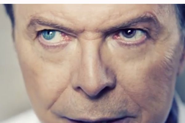 David Bowie különös szemeinek titka